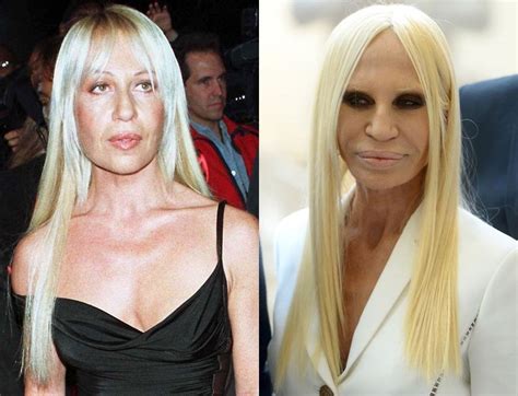 about donatella versace|donatella versace before and after surgery.